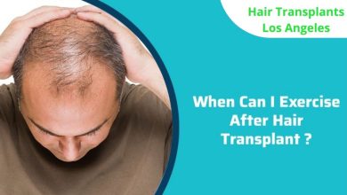 when-can-i-exercise-after-hair-transplant